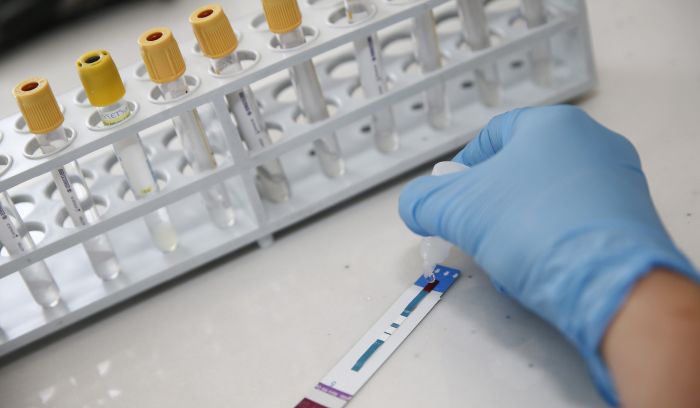 Ücretsiz Ve Anonim HIV Testi